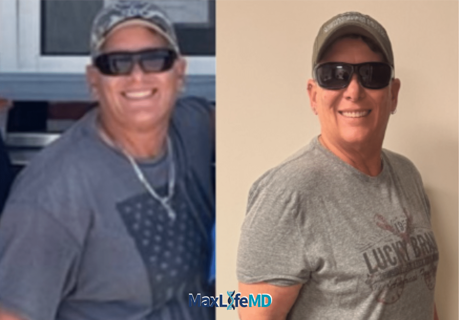 MaxLife MD Website GLP1 Tirzepatide NAD Energy Lose Weight Lose Fat Women 11