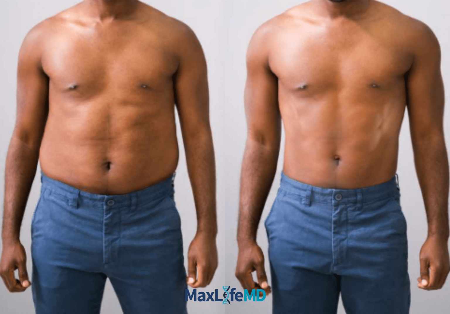 MaxLife MD Website GLP1 Tirzepatide NAD Energy Lose Weight Lose Fat Women 2