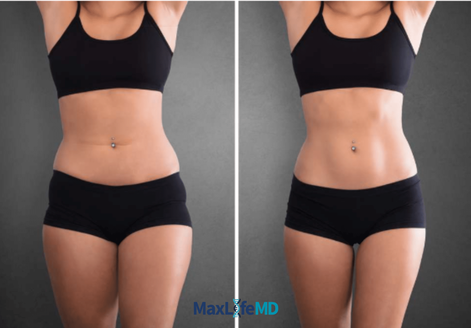MaxLife MD Website GLP1 Tirzepatide NAD Energy Lose Weight Lose Fat Women 3