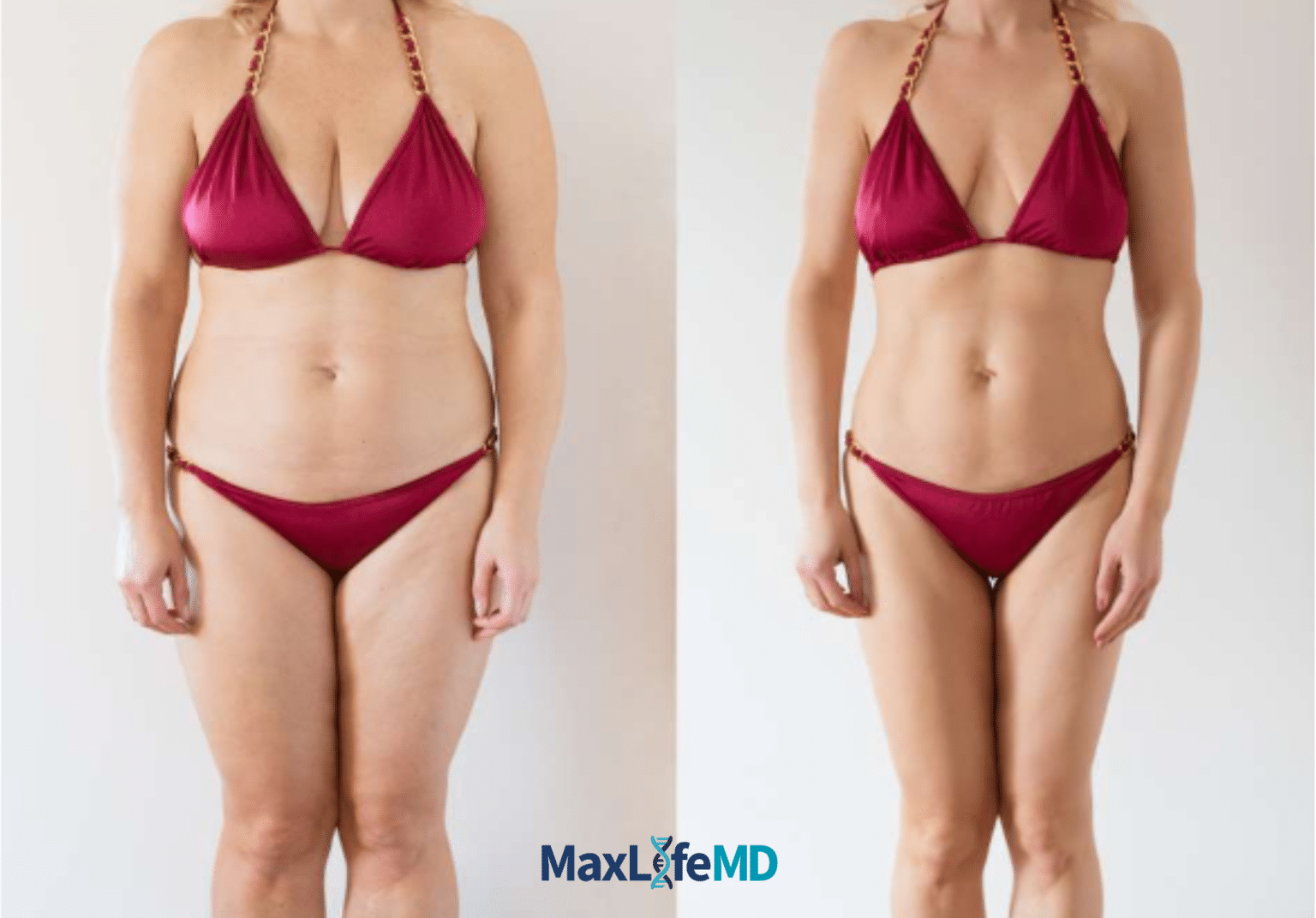 MaxLife MD Website GLP1 Tirzepatide NAD Energy Lose Weight Lose Fat Women 4