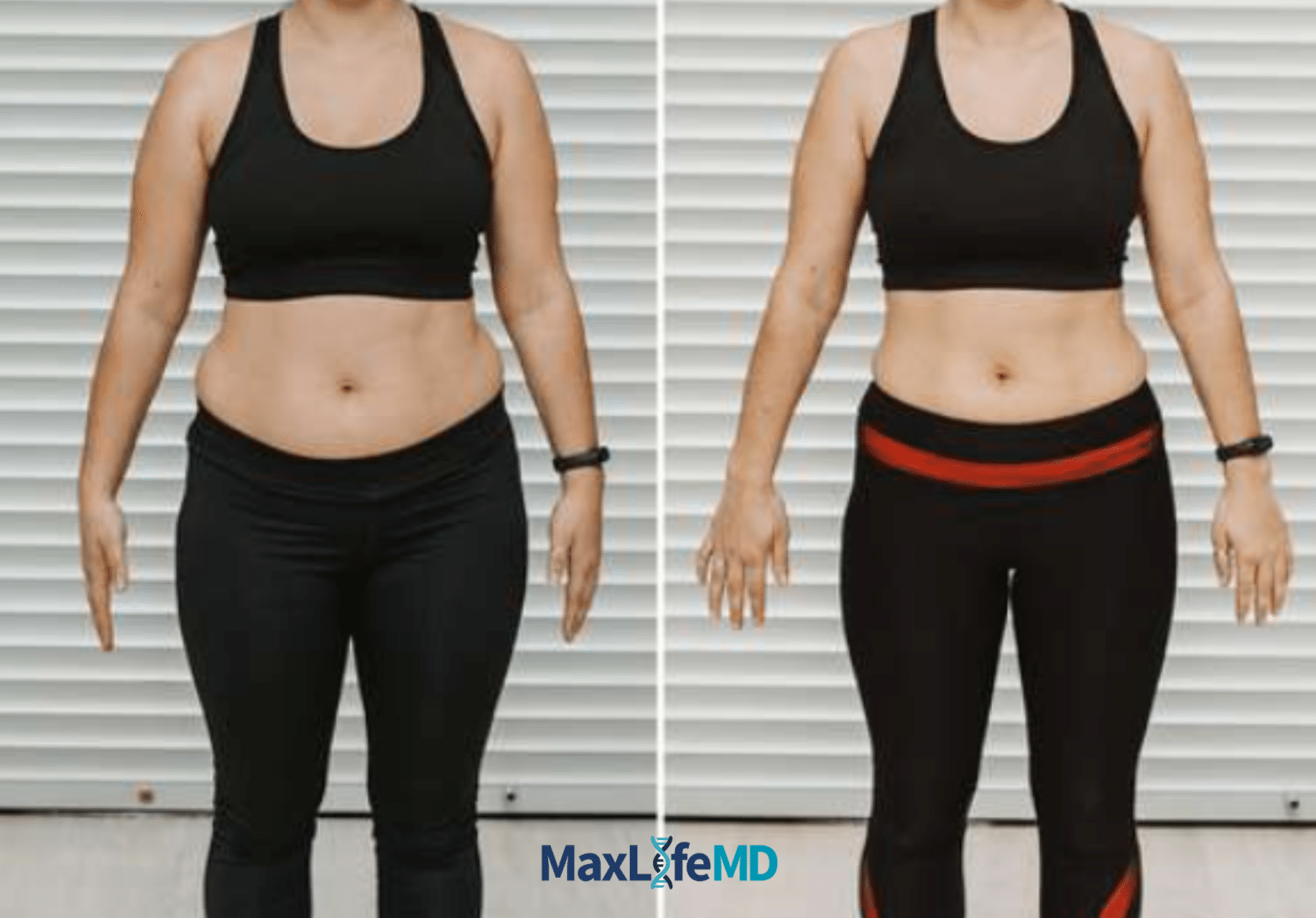 MaxLife MD Website GLP1 Tirzepatide NAD Energy Lose Weight Lose Fat Women 5
