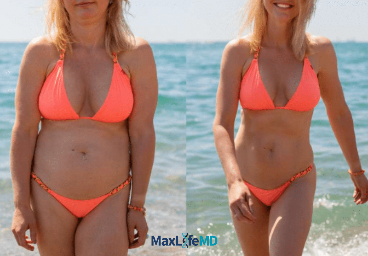 MaxLife MD Website GLP1 Tirzepatide NAD Energy Lose Weight Lose Fat Women 6