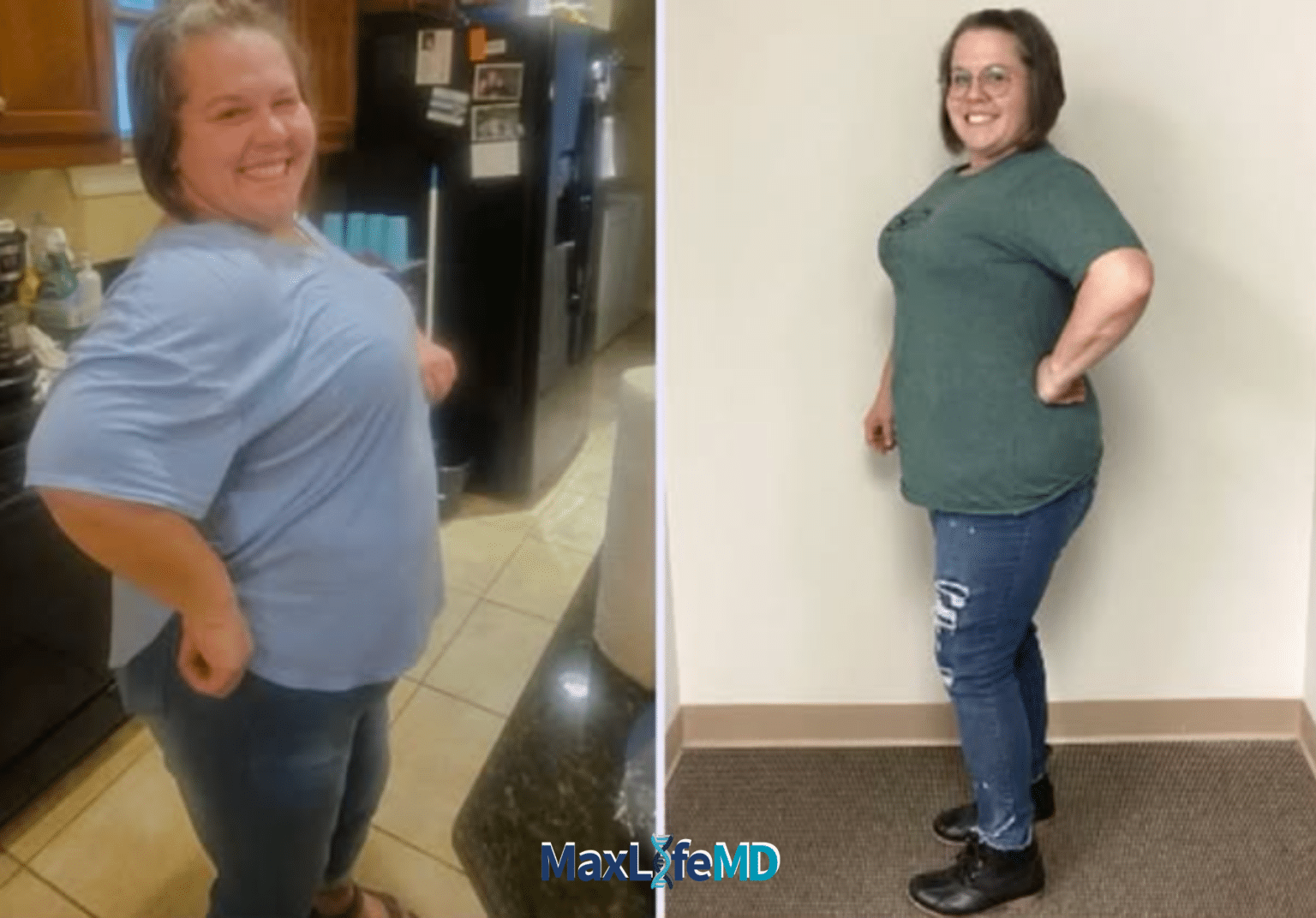 MaxLife MD Website GLP1 Tirzepatide NAD Energy Lose Weight Lose Fat Women 7