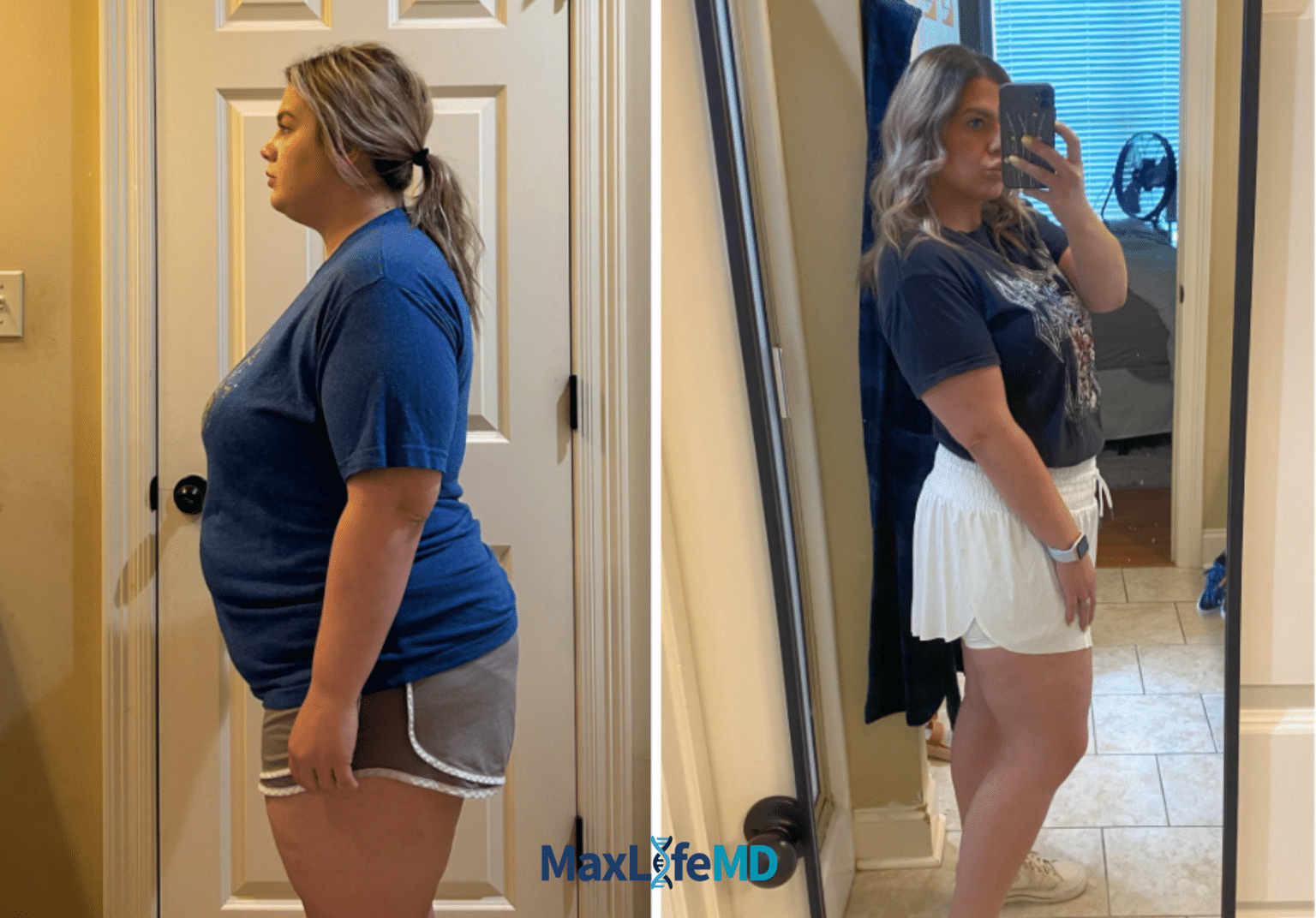 MaxLife MD Website GLP1 Tirzepatide NAD Energy Lose Weight Lose Fat Women 8